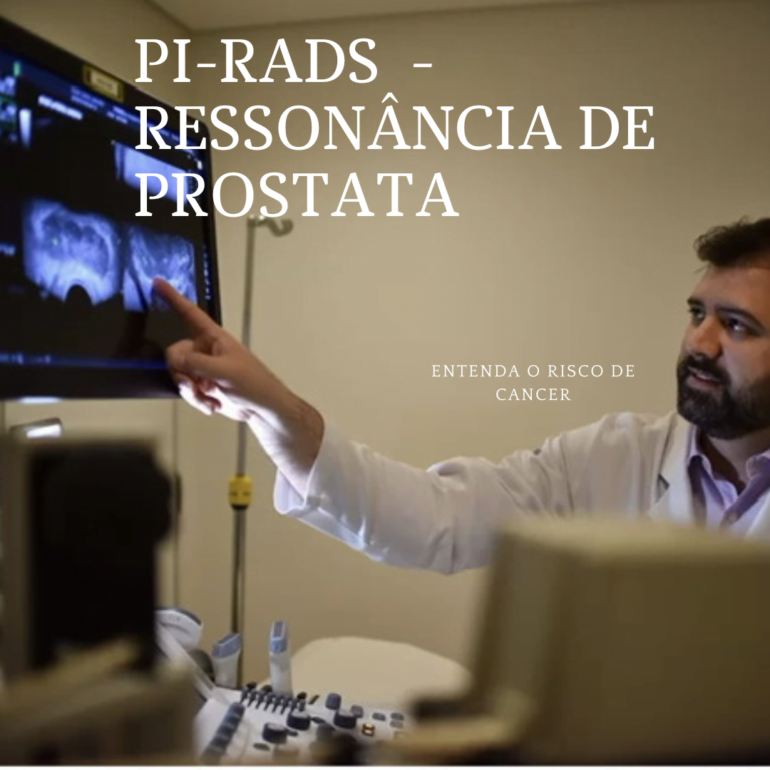 Recebi o resultado da minha Ressonância de Próstata. E agora? Entenda o PI-RADS.
